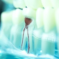 Root canals of tooth
