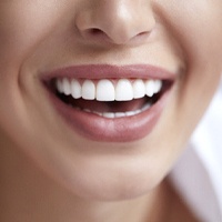 Closeup of woman smiling with veneers in Carlisle