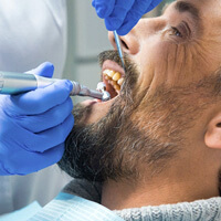 closeup of a man smiling during dental cleaning
