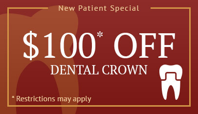 $100 off dental crown