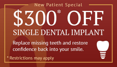 $300 off single implant