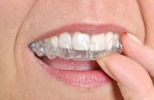  invisalign in carlisle is the clear solution