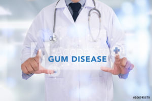 dental holding picture of gum disease